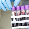 Microsoft supports Covid-19 global research