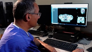 UK hospital uses new Azure AI system to cut waiting times for radiotherapy patients